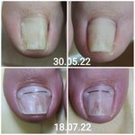 Podoestet (mikrorayon Stepnoy, 11), podology