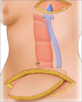 Plastic surgery Op. Dr. Rahmi Evinç/İzmir Plastik Cerrahi Uzmanı, Izmir, photo