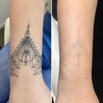 NetyTattoo Laser (Pyatnitskaya Street, 71/5с2) ، علم التجميل