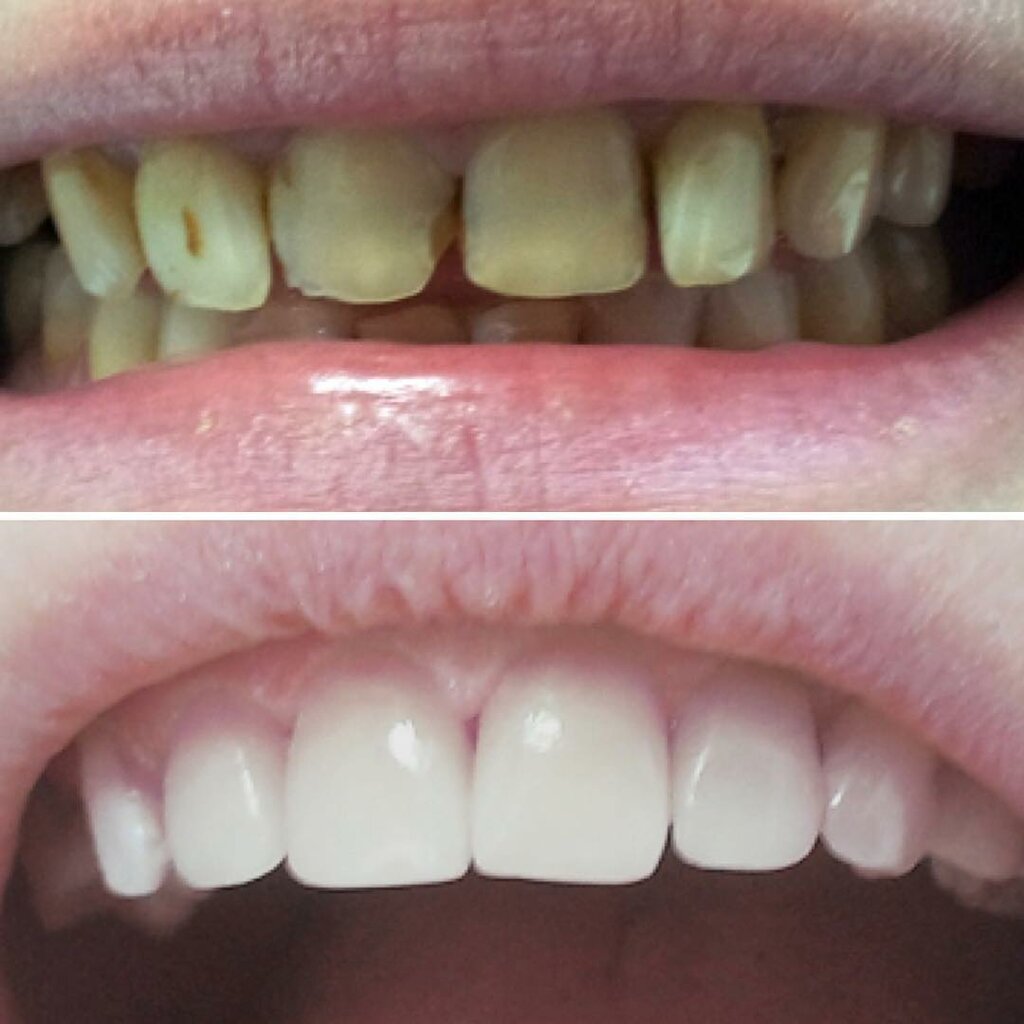 Dental Diamond özel ağız ve diş sağlığı klinikleri ve muayenehaneleri