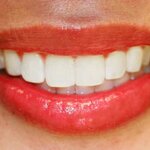 Stomatologicheskaya poliklinika, Rayonnaya, Mlpu (Ust-Dzheguta, ulitsa Morozova, 49), clínica dental