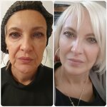 DoctorLola (Lobachevskogo Street, 118к4), cosmetology