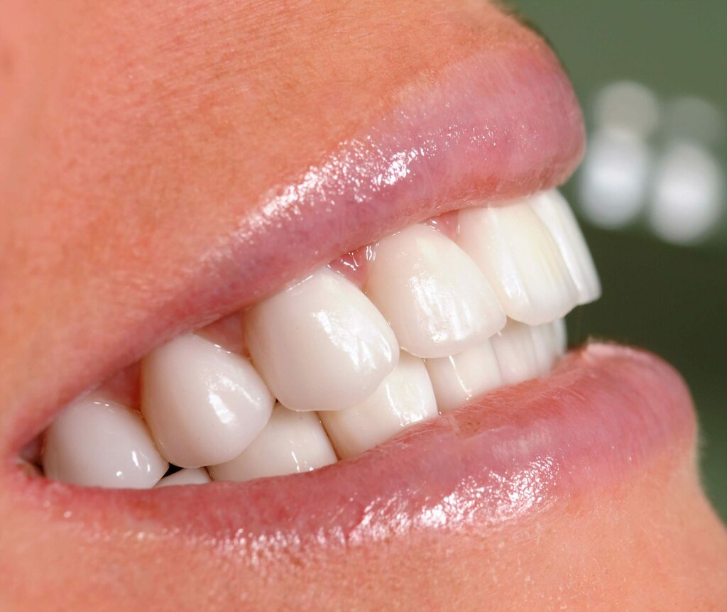Dental clinic Cosmetic Dentist, Dubai, photo