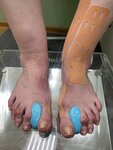 Individual Ortho Insoles (selo Vysokaya Gora, ulitsa Melioratorov, 9А), manufacture of prosthetic and orthopedic products