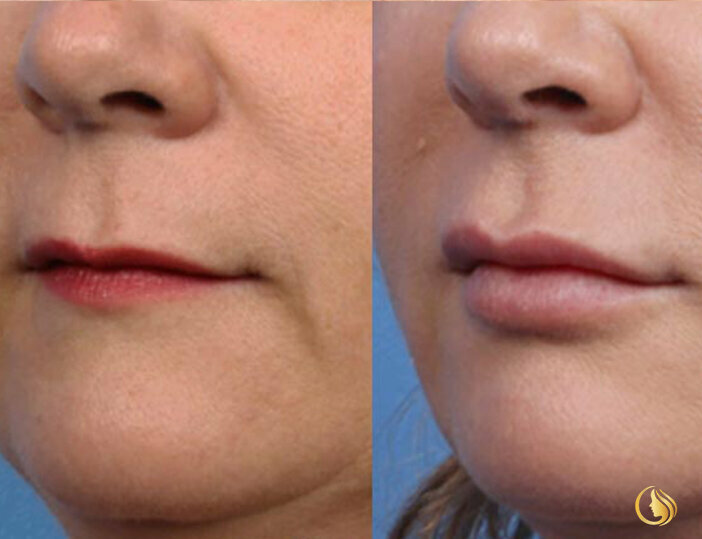 Plastic surgery Ladora Polyclinic, Dubai, photo