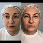 Косметолог Азарян Карина Николаевна (Nakhichevan, Komsomolskaya ulitsa, 3/16), private experts