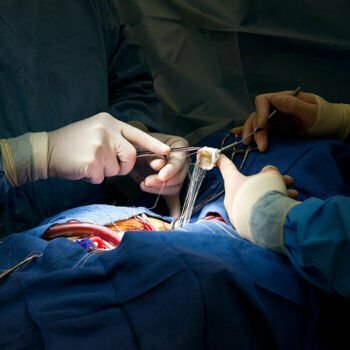 Private practice doctors Cardiovascular Surgery Specialist Prof. Dr. Yavuz Besogul, Istanbul, photo