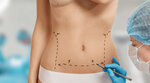Op. Dr. Halil Buldu (İstanbul, Şişli, Vali Konağı Cad., 94A) ، أطباء بعيادات خاصة