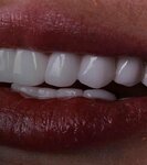 Specialist Dr. Musa Kartoz (Antalya, Muratpaşa, Şirinyalı Mah., İsmet Gökşen Cad.) ، عيادات الأسنان