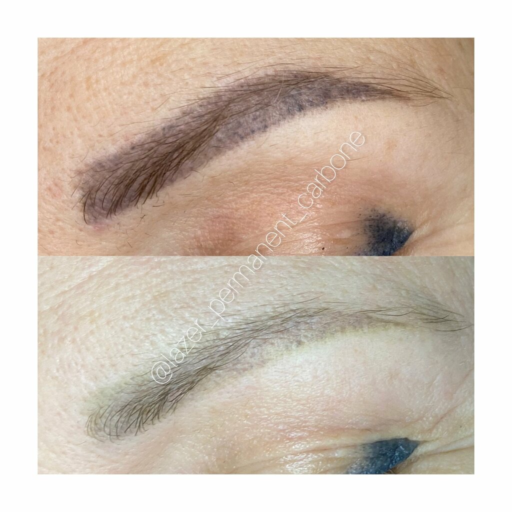 Tattoo studio Студия удаления тату и татуажа, Gelendgik, photo