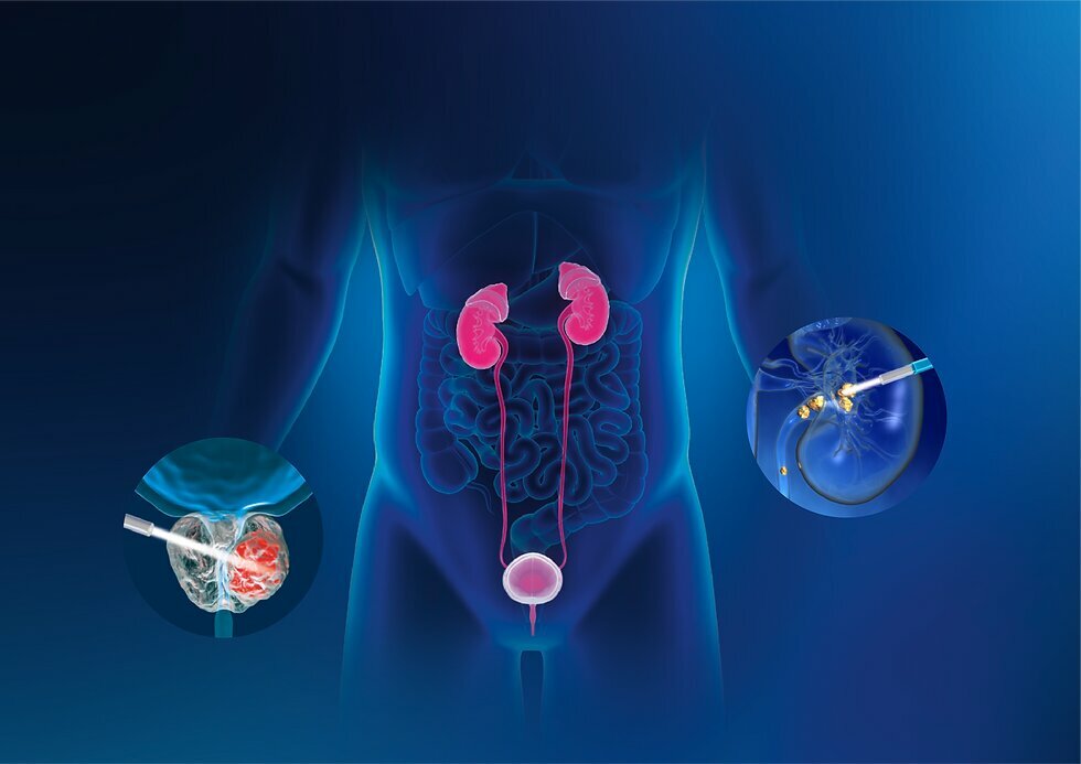 Medical equipment Promedical, Istanbul, photo