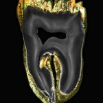 Marble Dental Clinic (Blue Tower, Trade Center First, Jumeirah, Dubai), dental clinic