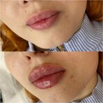 Гламур (ulitsa Volodarskogo, 17Ж), cosmetology