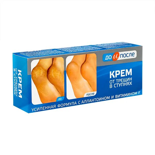 Крем для ног от трещин в ступнях 