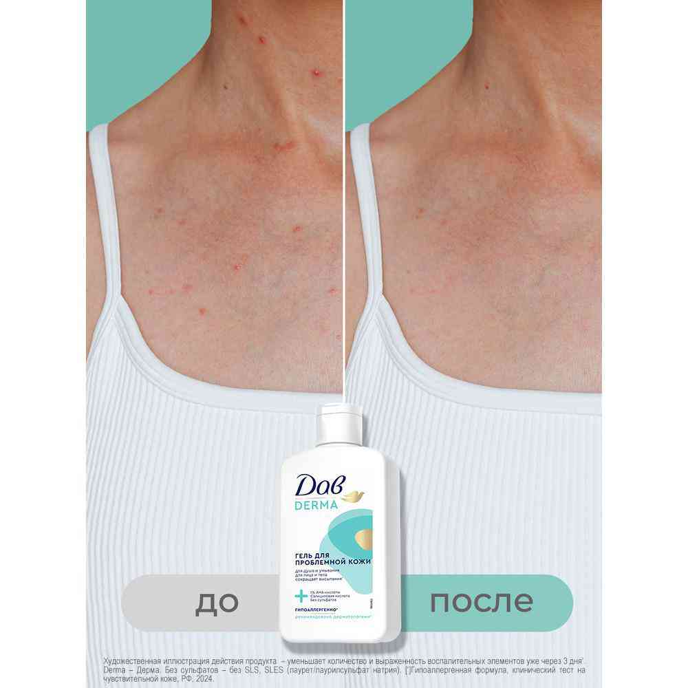 

Гель для душа и умывания Дав Derma для проблемной кожи 280 мл