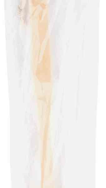 Массажёр 2 в 1 антицеллюлитный Banika со щёткой, 8×7×42 см