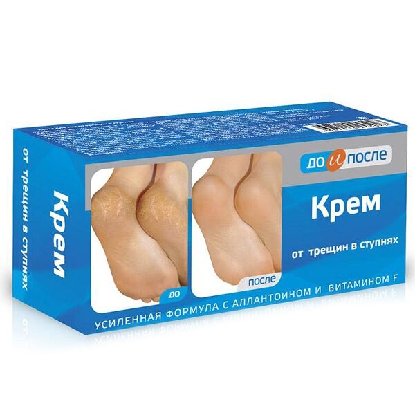 До и После крем для ног от трещин в ступнях 150 мл