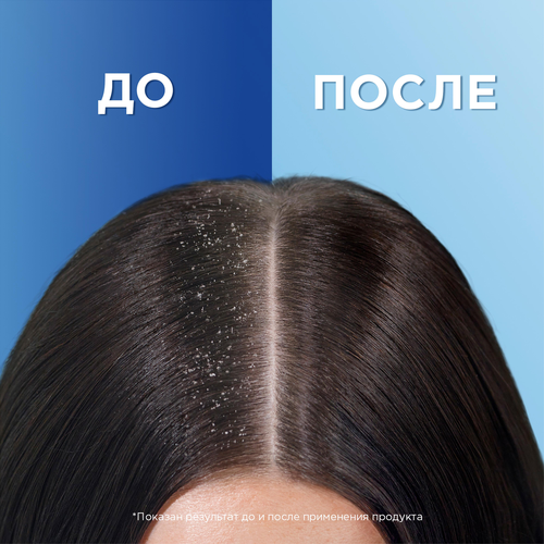 

Шампунь для жирных волос Head&Shoulders Цитрусовая свежесть 400 мл