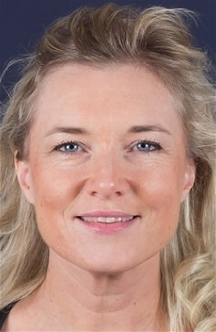 Lotten Roos - Yawiki