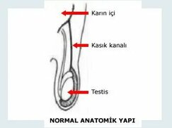 antalyacocukcerrahi.com sitesinden görsel