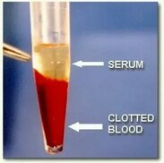 laboratoryinfo.com sitesinden görsel
