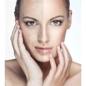 Garnier Saf Temiz 150 ml Arındırıcı Peeling