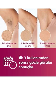 Philips Lumea Ipl Lazer Epilasyon Sense IQ 400.000 ATIM - Uzun Ömürlü Kullanım - Full Set
