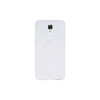 Royal Cover Lg x Screen Kılıf Esnek ve Şeffaf Premium Tpu Silikon Kapak Rcv / Ss