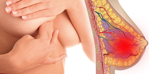 Причины боли в груди при грудном вскармливании и способы ее устранения