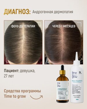 Клинический случай из практики врача-дерматолога, трихолога, трихотрансплантолога, терапевта, члена РОИВ, РООСТВ, LAHRC…