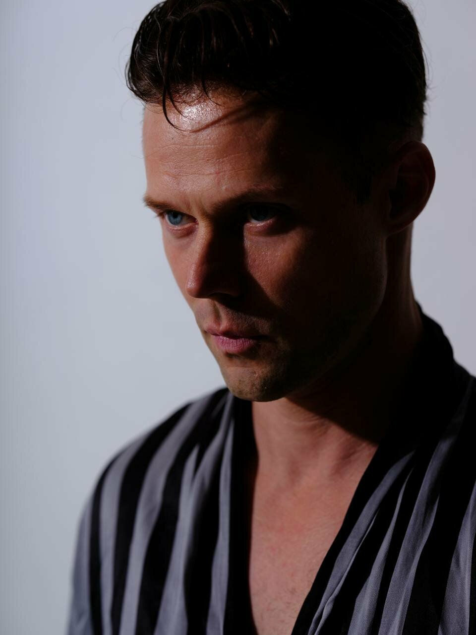 Даниил воробьев до и после пересадки волос