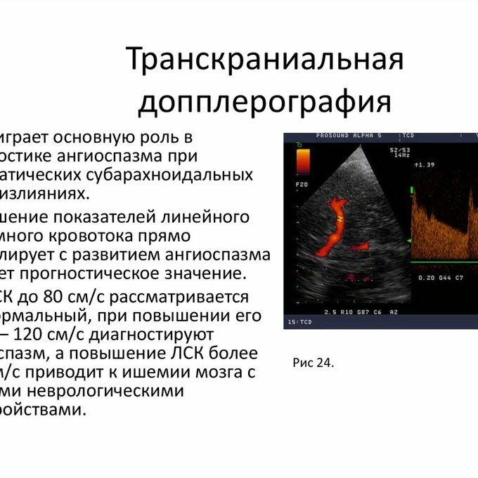 Ультразвуковое исследование головного мозга (с транскраниальной допплерографией + УЗИ сосудов шеи) 