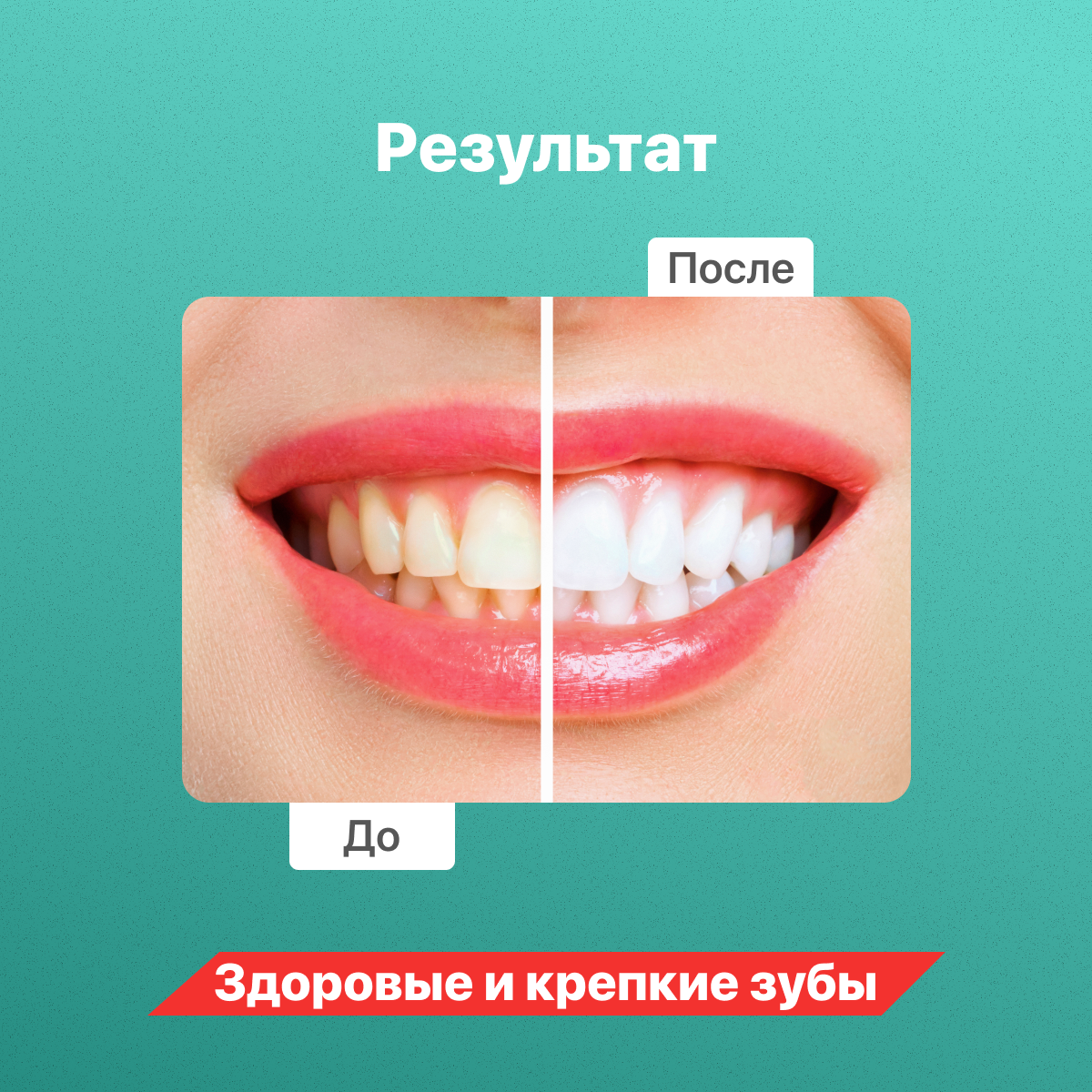 Сменные насадки Colgate для электрической зубной щетки мягкие Proclinical 150 2 шт - фотография № 3