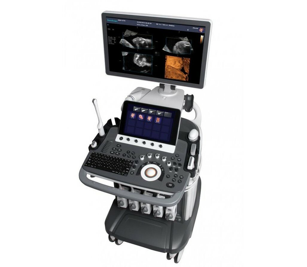 Ультразвуковой сканер S40Exp