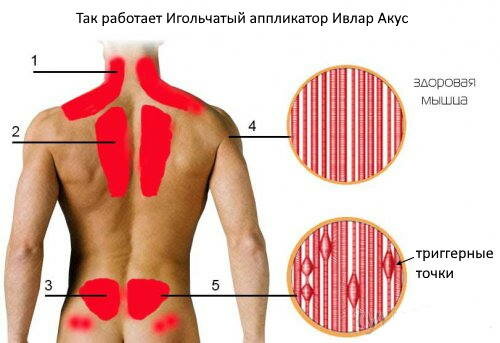 Аппликатор Кузнецова с металлическими иглами ивлар медус, размер 240х60 мм, цвет оранжевый, шаг игл 6.5 мм - фотография № 5