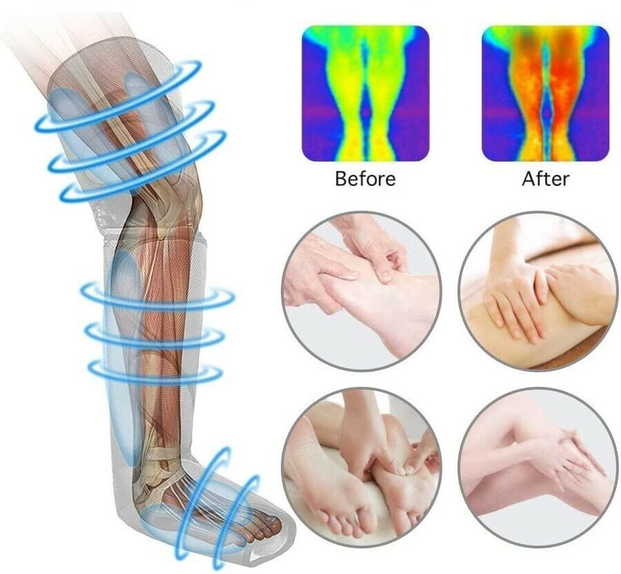 Лимфодренажный массажер для ног - фотография № 3