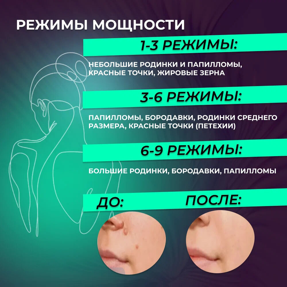 Плазменная ручка (Mole Freckle Removal Pen) для удаления бородавок и папиллом (9 режимов)