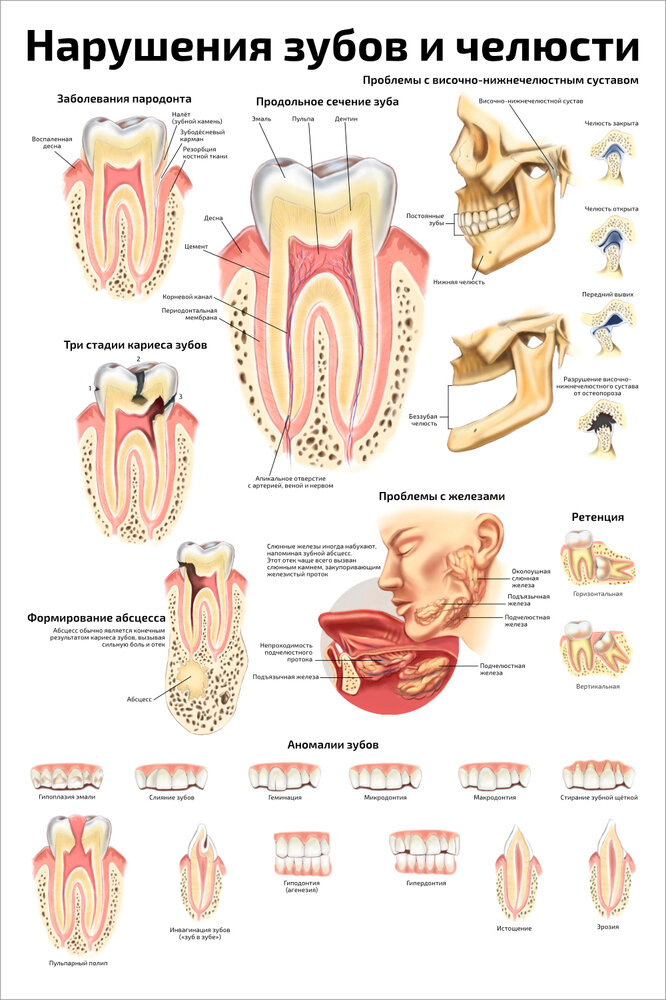 Плакат Квинг Нарушения зубов и челюсти ламинированный 457×610 мм ≈ (А2)