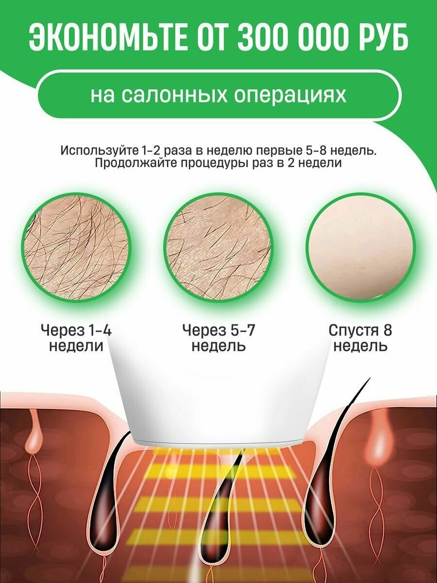 Фотоэпилятор лазерный IPL - фотография № 5