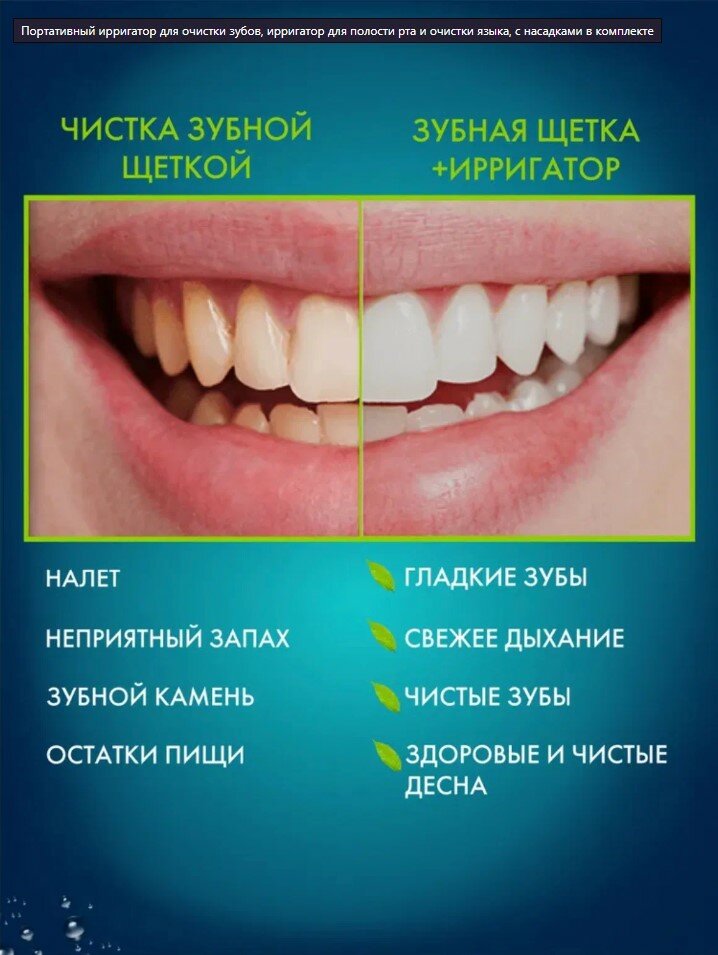 Портативный ирригатор для очистки зубов, ирригатор для полости рта и очистки языка, с насадками в комплекте - фотография № 5