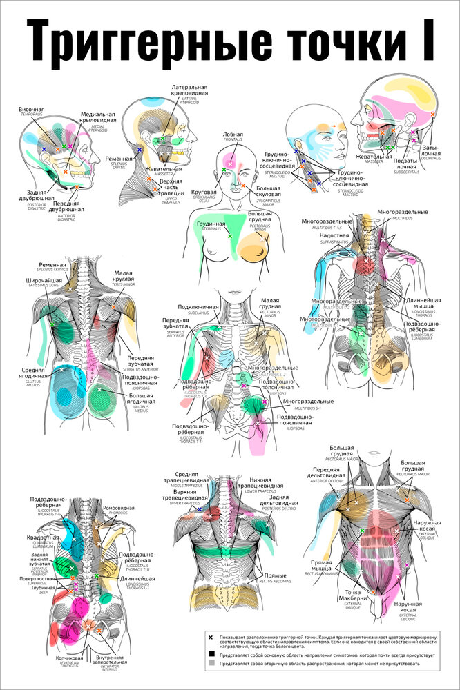 Плакат Квинг Триггерные точки I ламинированный 457×610 мм ≈ (А2)