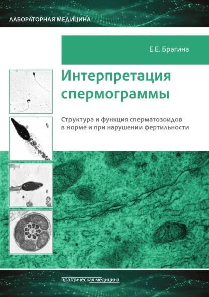 Книга Интерпретация спермограммы: структура и функция сперматозоидов в норме и при наруш. - фото №1