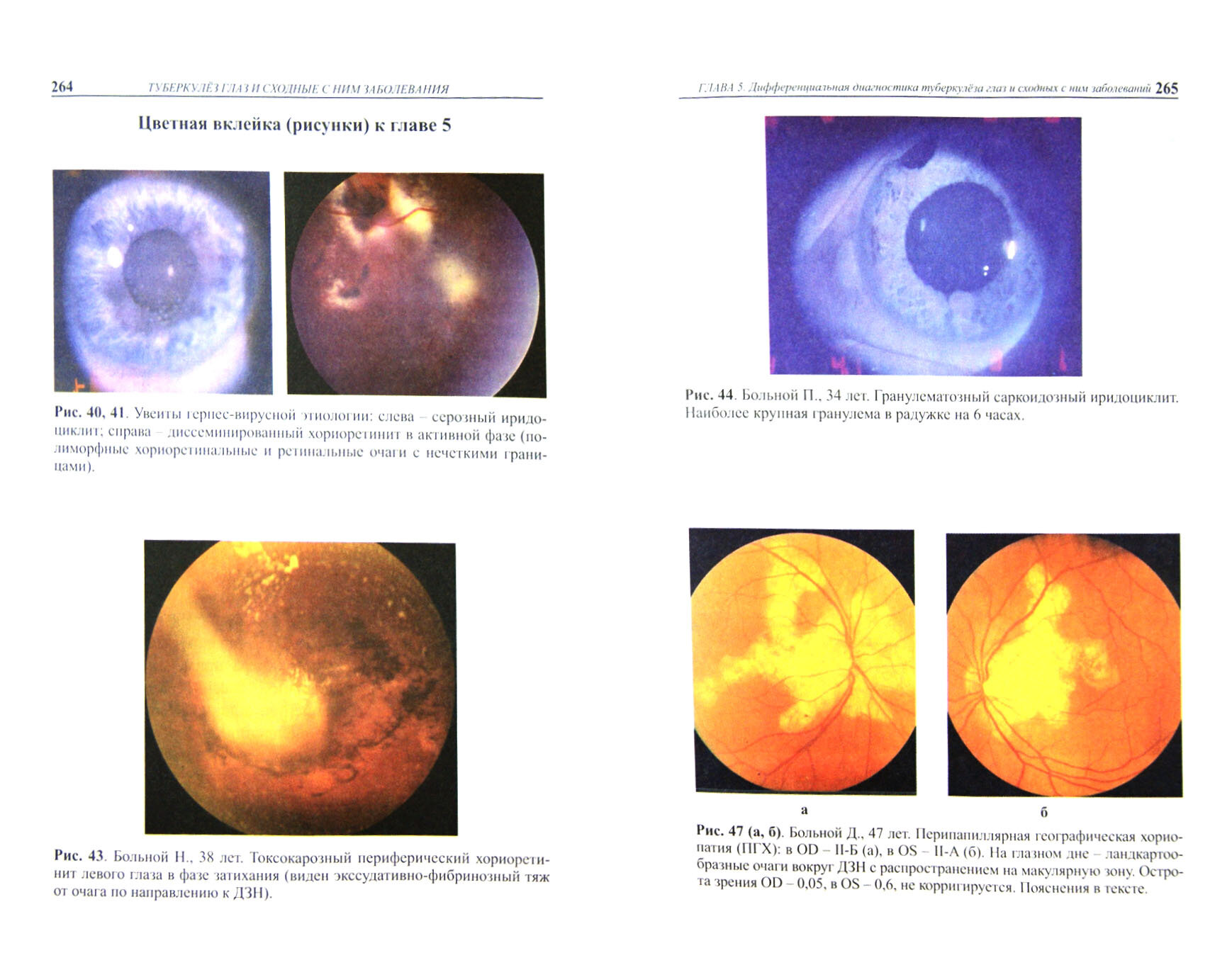Туберкулез глаз и сходные с ним заболевания. Руководство для врачей - фото №2
