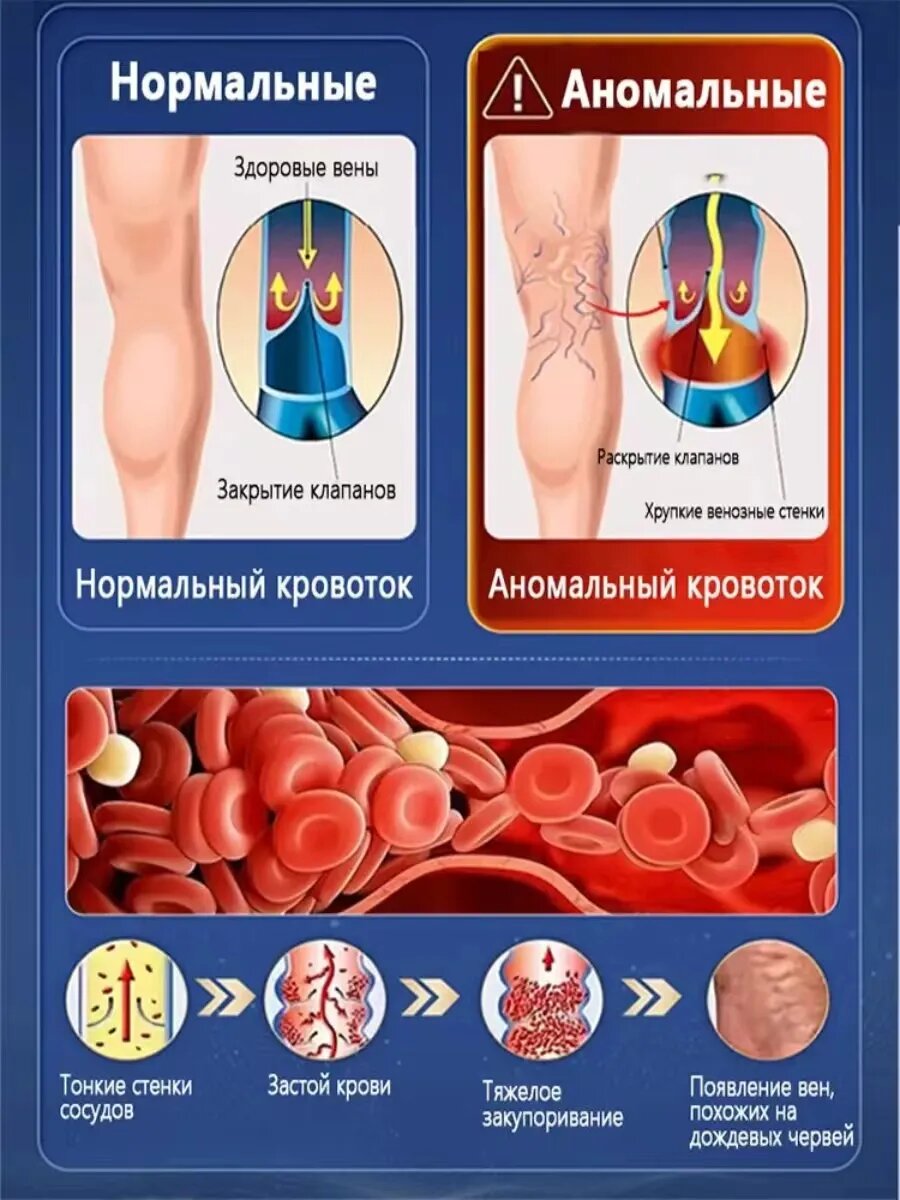 Изображение Мазь от варикоза вен на ногах 50g