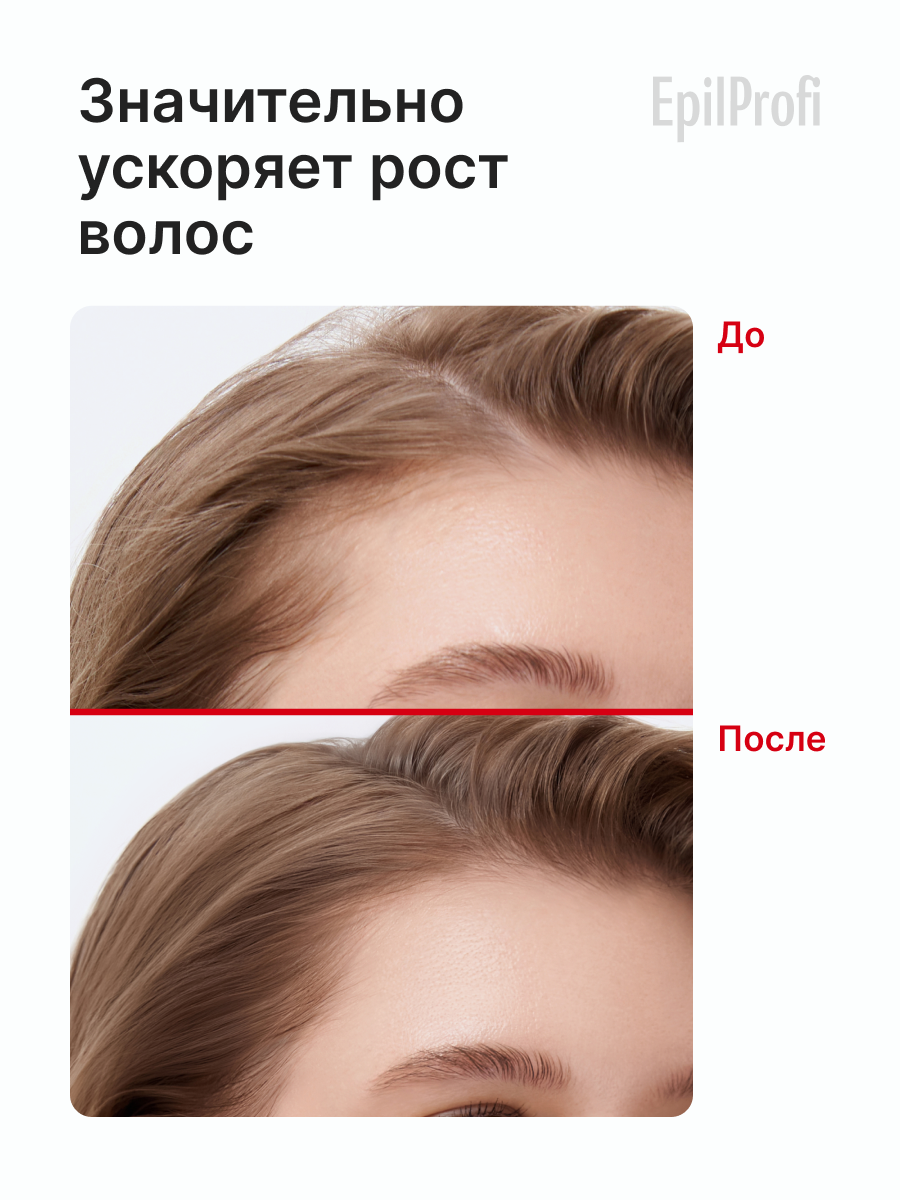 EpilProfi / Маска для волос активатор роста с красным перцем, 500 мл — фото 1