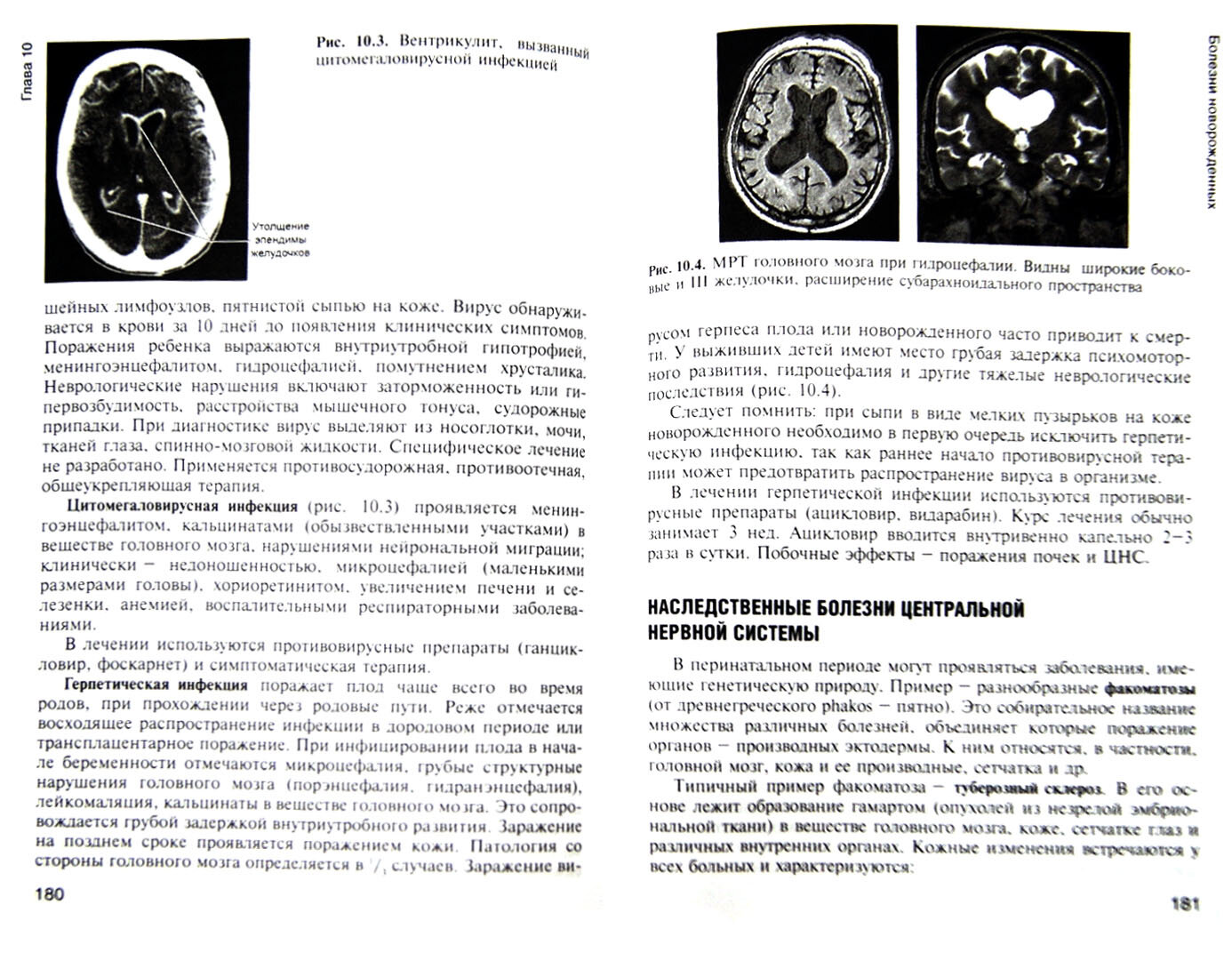 Сестринское дело в неврологии (Котов Сергей Викторович, Богданов Р. Р., Исакова Е. В.) - фото №3