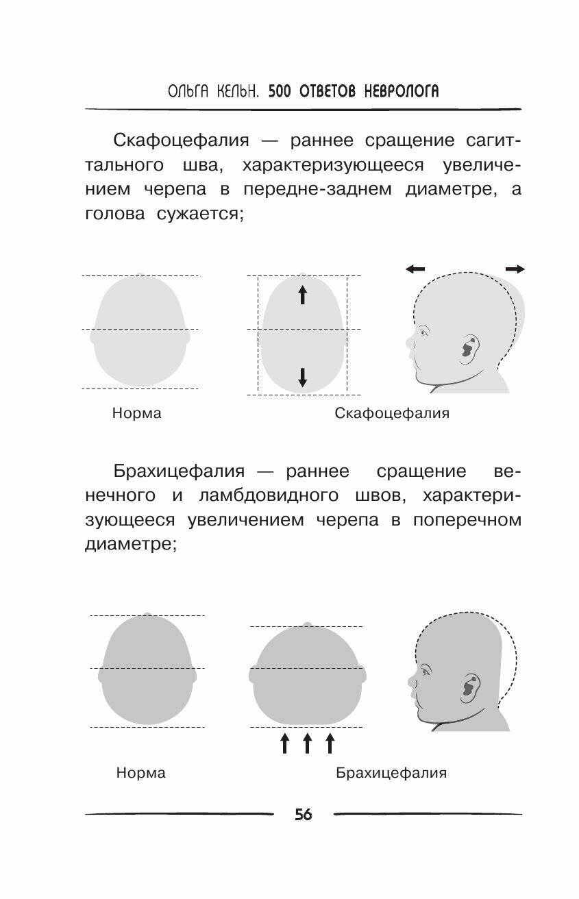 500 ответов невролога (Кельн Ольга Леонидовна) - фото №9