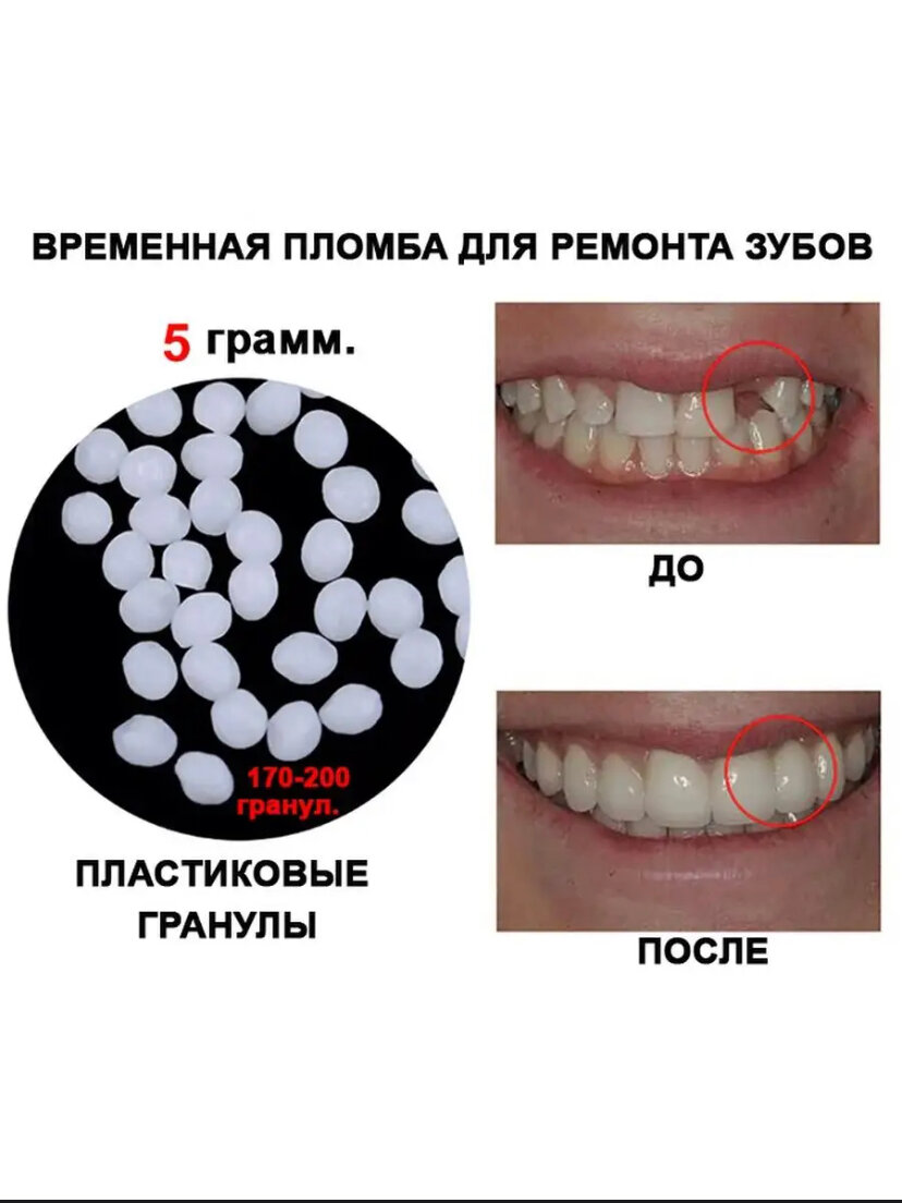 Временная пломба