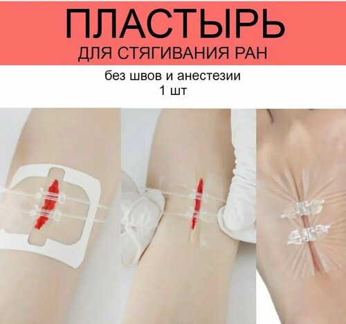 Пластырь для стягивания ран, пластырь-стяжка ранозаживляющий ...