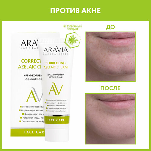ARAVIA Крем-корректор Laboratories Azelaic Correcting Cream, 50 мл aravia крем корректор laboratories azelaic correcting cream 50 мл